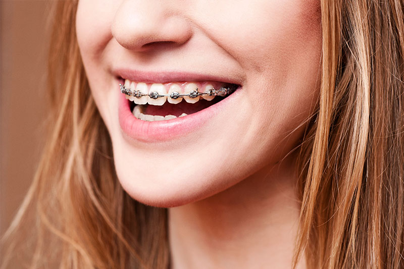 Orthodontics in Danville